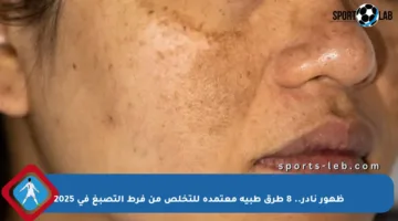 ظهور نادر.. 8 طرق طبية معتمدة للتخلص من فرط التصبغ في 2025